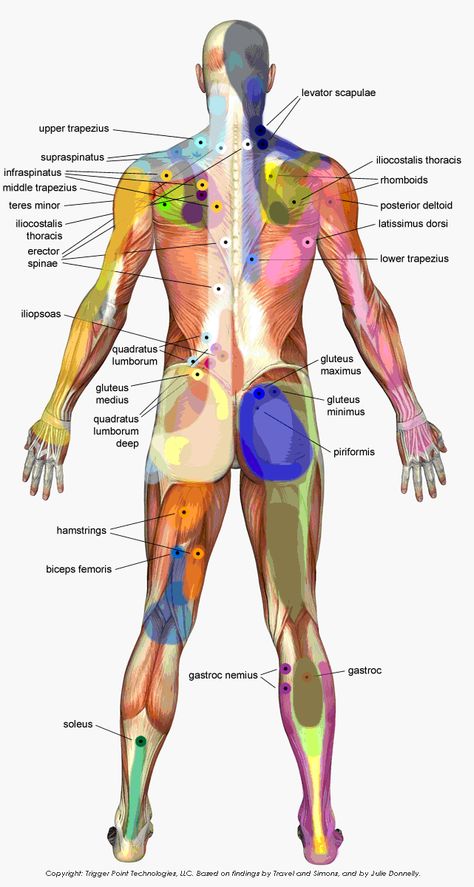 Trigger Points from the back Head Diagram, Punkty Spustowe, Autogenic Training, Trigger Point Massage, Bolesti Chrbta, Trigger Point Therapy, Reflexology Massage, Trigger Point, Sports Massage