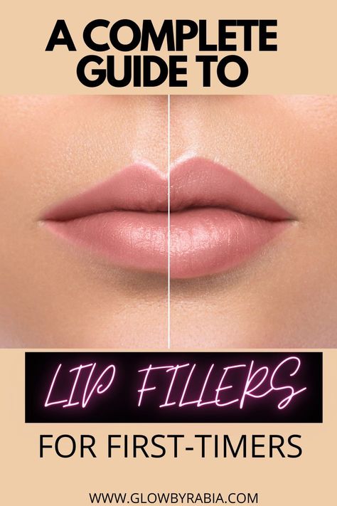 Lip Augmentation Shapes, Small Lip Injections Before And After, 1.5 Lip Filler, Getting Lip Fillers, Lip Injections Shapes Before And After, Best Lip Filler, How Long Does Lip Filler Last, Vermillion Border Lip Filler, Juvederm Volbella Lips