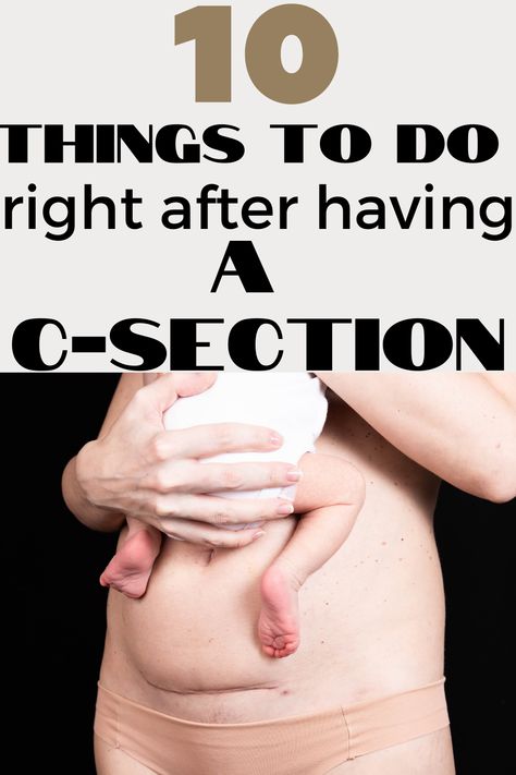 Csection recovery tips. Csection tips. C-section tips for new mom. Scheduled c-section tips. Postpartum recovery tips. Csection recovery tips. What to expect after having a csection. Fitness After C Section, C Section Shelf Get Rid Of, After C Section Recovery Tips, C Section Healing, Csection Postpartum Care, Cesarian Section, Healing From C Section, Scheduled C Section, Post C Section