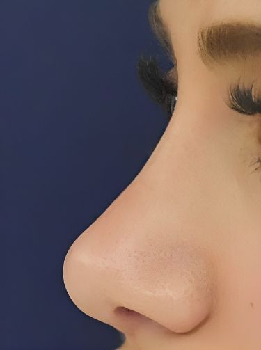 Love your nose! 💖 Find inspiration for nose contouring, makeup, and enhancement. Embrace your unique beauty. #noseinspo #noseaesthetic #selflove #nosebeauty #confidence Contouring Ideas, Nose Contouring Makeup, Nose Profile, Upturned Nose, Dream Nose, Nose Types, Straight Eyebrows, Straight Nose, Nose Makeup