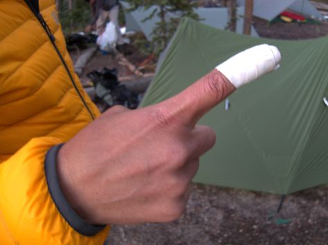 Bandaged finger after a suture-worthy knife cut. Thankfully, we were already planning to exit the next day. Finger Bandage, Backpacking Gear List, Google Doc, Gear List, Thru Hiking, Backpacking Gear, List Template, Foot Care, Backpacking Travel