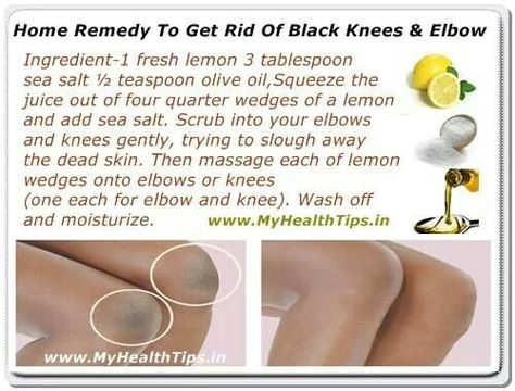 Home Remedy to Get Rid of Black Knees & Elbow Exfoliating Lip Scrub, Dark Underarms, Lip Exfoliator, Beauty Remedies, Mascara Facial, Skin Cleanser Products, Black Knees, Health And Beauty Tips, Hair Skin