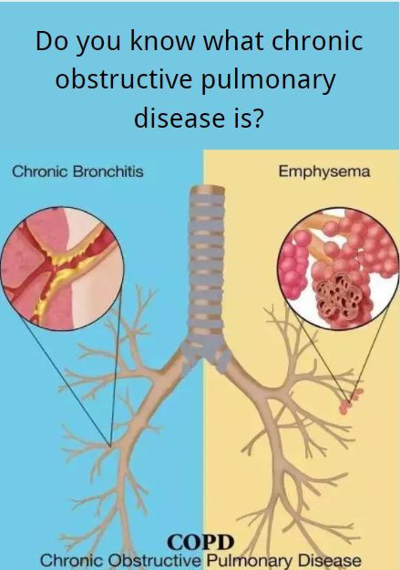 Do you know what chronic obstructive pulmonary disease is? #boxym #healthy #chronic #copd Remedies For Bronchitis, Home Remedies For Bronchitis, Lung Health, Severe Asthma, Chronic Obstructive Pulmonary Disease, Lungs Health, Pulmonary Disease, Health Ideas, Asthma Attacks