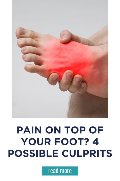 Pain on Top of Your Foot? 4 Possible Culprits Achy Feet Relief, Foot Exercises For Pain, Foot Pain Chart, Top Of Foot Pain, Foot Pain Relief Remedies, Flat Feet Pain, K Tape, Heel Pain Relief, Arthritic Pain