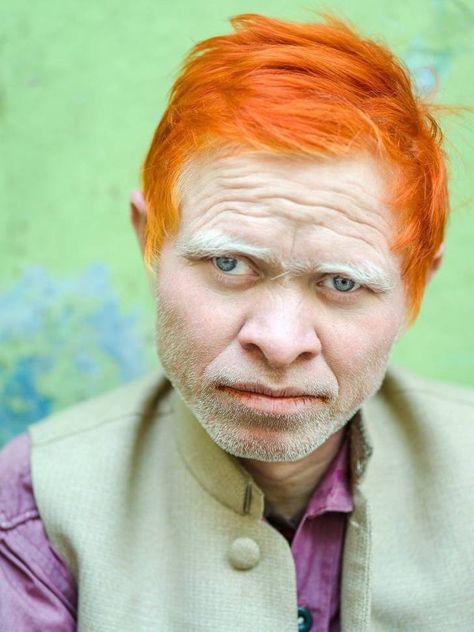 Albino People, Carolina Do Norte, Rainbow Eucalyptus, Hand Shadows, Street Portrait, Seven Wonders, Maine Coon, People Around The World, National Geographic