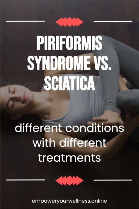 Looking for piriformis syndrome relief? If you've been stretching and stretching with no improvement, check out this blog post on the difference between piriformis syndrome and sciatica, and other common injury symptoms. These two conditions seem similar but have different underlying causes and respond to different treatments. Sciatic Nerve Exercises, Sciatic Nerve Stretches, Sciatica Stretches, Sciatica Symptoms, Yoga Information, Piriformis Stretch, Piriformis Syndrome, Sciatica Pain Relief, Nerve Pain Relief