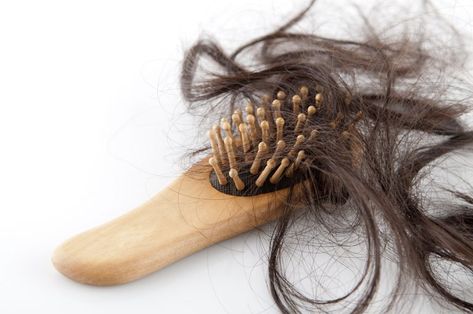 7 Reasons Why You're Losing Your Hair and What to Do About it - Holistic Wellness Good Dry Shampoo, Female Pattern Baldness, Diy Hair Masks, Hair Care Regimen, Excess Hair, Luscious Hair, Grow Hair Faster, Normal Hair, Hair Problems