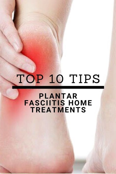 Plantar Fasciitis top 10 home and natural remedies Doterra Oils For Planters Fascitis, What Is Plantar Fascia, Home Remedy For Plantar Facitis, Planterficitis Foot, Planter Facitis Relief Home Remedies, Plantar Facitis Signs, Plantar Faciatis Pain Relief, Plantar Fascia Shoes, Shoes For Plantar Fascia