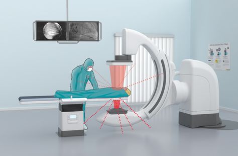 Radiographic Positioning, Airport Xray Machine, Medical Radiation Technologist, Xray Machine, Radiation Burn, Diagnostic Radiography, Chest X Ray Interpretation, Radiation Exposure, Medical Animation