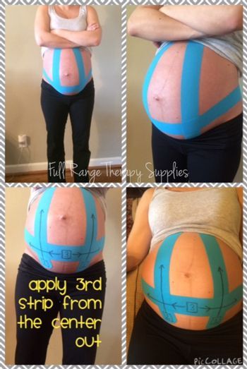 Kinesio Taping for Pregnant Women in third trimester Therapy Supplies, 5 Weeks Pregnant, K Tape, Kinesio Taping, Mommy Workout, Pumping Moms, Baby Sleep Problems, Third Baby, Third Trimester