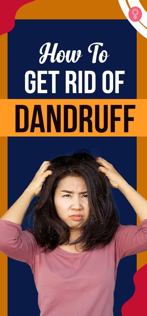 Home Remedies For Dandruff, Rid Of Dandruff, Dandruff Remedy, Getting Rid Of Dandruff, Hair Remedies For Growth, Dandruff Shampoo, Anti Dandruff, Hair Breakage, Natural Home Remedies