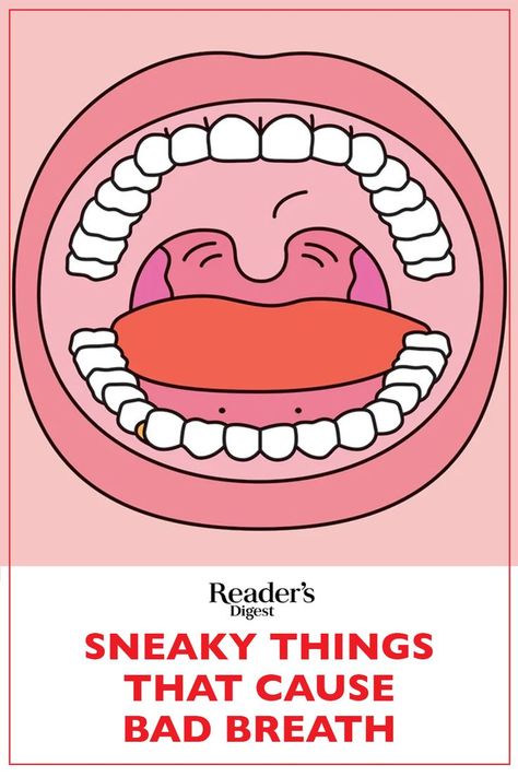 The best way to beat bad breath is to stamp it out at its source. Here's how. Mouth Care, Prevent Bad Breath, Bad Breath Remedy, Healthy Book, Common Factors, Natural Antibiotics, Natural Teeth Whitening, Creating A Newsletter, Cold Sore