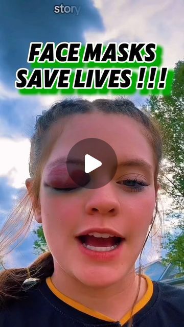 W. O. W. SOFTBALL on Instagram: "#FACE MASKS SAVE LIVES !!! 
Thanks to Mads to letting us share her story …listen to her story and video at the end !!! 
#softball #wow #WOWsoftball #masks #save #lives #hit #ambulance #eye #story #time" Instagram Face, Wear A Mask, Save Life, Ambulance, Story Time, Softball, Face Masks, The End, Mask