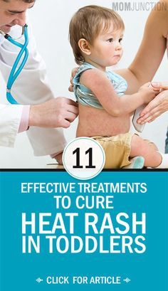 If your toddler has developed heat rash, the most important thing to ensure is that your toddler’s skin and body remain cool. Here are a few things you can do to help treat it at the earliest. Skin Rash Remedies, Baby Heat Rash, Heat Rash Remedy, Baby Rashes, Body Rash, Rashes Remedies, Baby Feeding Schedule, Heat Rash, Kids Healthy