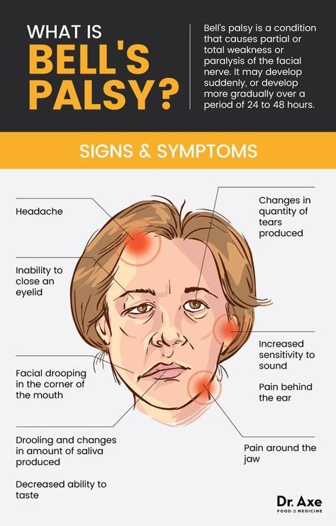 Medical Instagram, Bell’s Palsy, B12 Injections, Bells Palsy, Facial Nerve, Respiratory Illness, Nerve Damage, Medical Knowledge, Vitamin B12