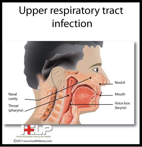 Upper Respiratory Tract Infection Upper Respiratory Tract, Natural Decongestant, Human Body Temperature, Upper Respiratory Infection, Lip Care Routine, Respiratory Infection, Respiratory System, School Project, Lungs