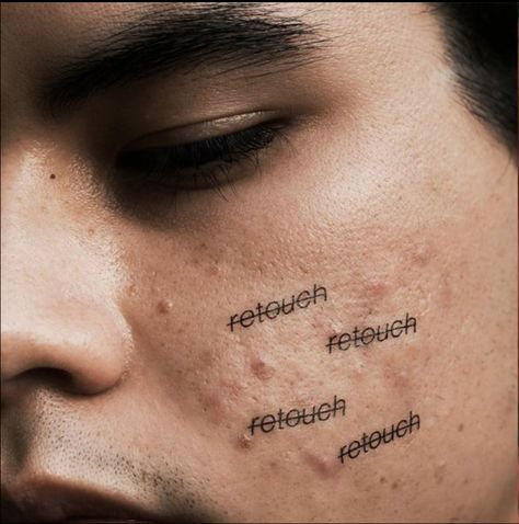 "Retouch," Peter DeVito, 20, a photographer from New York, used to heavily Photoshop his own pictures but has since stopped to create a powerful movement online. Artist: Peter DeVito Acne Help, Skin Model, Ex Machina, Foto Art, Beauty Standards, Tan Skin, Photography Projects, Insta Photo, Body Image