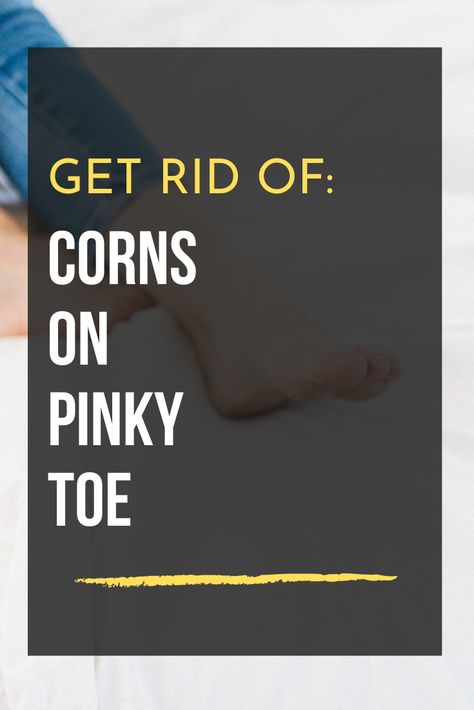 If you’re desperate to know how to get rid of corns on pinky toe, you understand how painful these skin bumps can be. Corns are thick, ha... Remove Corns On Feet Remedies, Get Rid Of Corns On Feet Fast, Foot Corn Removal Remedies, How To Get Rid Of Corns On Toes, Corn Removal On Toes, Get Rid Of Corns, Feet Remedies, Corn Removal, Throat Remedies