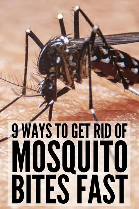 How To Stop The Itch Of Mosquito Bites, What Is Good For Mosquito Bites, Diy Mosquito Bite Itch Relief, What To Do For Mosquito Bites, Remedy For Mosquito Bites Itch Relief, Mosquito Bites Remedy, What To Use For Mosquito Bites, Itchy Bug Bites Remedy Itch Relief, Natural Itch Relief For Bug Bites