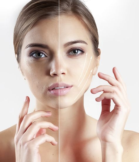 Sagging skin on face is not the end of the world - here's how you can help this situation without undergoing surgery. Sagging Skin Face, Saggy Face, Chin Wrinkles, Feminine Tips, Face Lift Exercises, Sagging Face, Face Lift Surgery, Infant Care, Heath Care