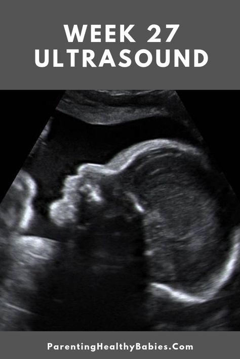 27 Week Pregnancy, Baby Ultrasound Pictures, 27 Weeks Pregnant, Pregnancy Ultrasound, 20 Weeks Pregnant, Pregnancy Week, Baby Ultrasound, Ultrasound Pictures, Girl Guide