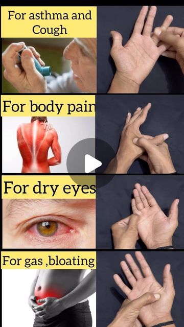 Acupressure Points Chart, Acupuncture Points Chart, Pressure Point Therapy, Chinese Massage, Massage Points, Relieve Gas, Acupressure Therapy, Hand Reflexology, Eye Pain