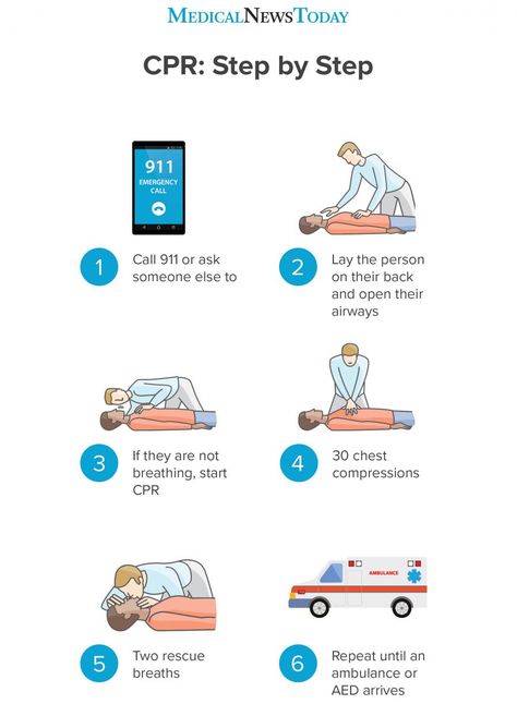 How to perform CPR: Guidelines, procedure, and ratio How To Cpr, Infant Cpr Printable, Cpr Steps, Basic Life Support Training, Cpr Poster, Cpr Instructions, Cpr Instructor, First Aid Steps, How To Do Cpr