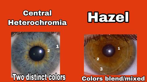 Central heterochromia vs hazel eyes differences. (I do not own the pictures used here. Used for educational purposes). found in google: credits to original owners #hazel #hazeleyes #heterochromia #heterochromiaeyes #eyes #eyecolor #centralheterochromia Sectoral Heterochromia, Central Heterochromia, Pretty Eyes Color, Heterochromia Eyes, Different Types Of Eyes, Rare Eye Colors, Hazel Green Eyes, Rare Eyes, Hazel Eye Makeup