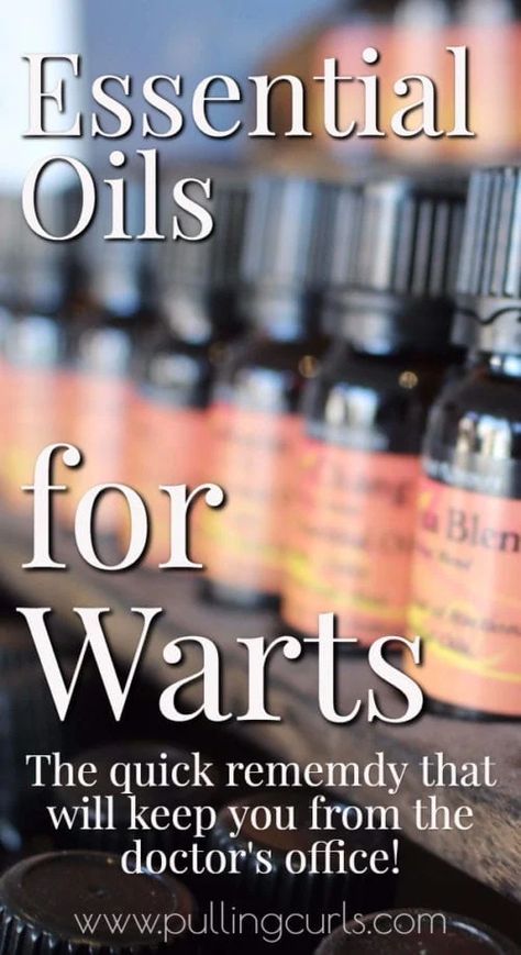 Essential Oils Warts, Warts On Hands, Warts On Face, Home Remedies For Warts, Warts Remedy, Wart Remover, Remove Warts, Get Rid Of Warts, Cold Sores Remedies