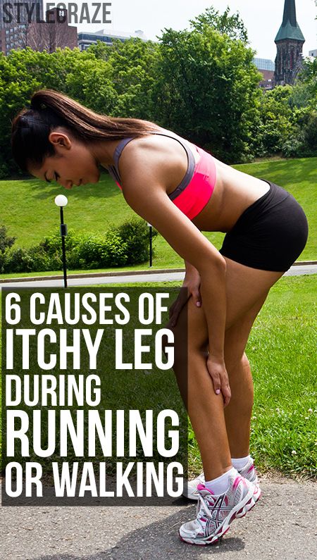 6 Serious Causes Of Itchy Leg During Running Or Walking Itchy Legs, Morning Jog, Heath And Fitness, After Workout, Legs Workout, Health And Beauty Tips, Helpful Tips, Healthy Tips, Fitness Inspo