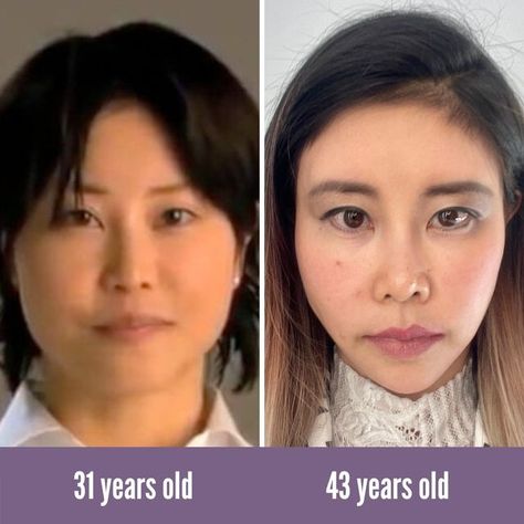 KOKO FACE YOGA on Instagram: "Today's #transformationtuesday features our very own Koko Hayashi! Can you believe the difference? 😱 Share your favorite before and after photos 👇 #kokohayashi #kokofaceyoga #faceyoga #beforeafter #transformation #transformationtuesday #glowup #glowupchallenge #beauty #faceyogaexpert #faceyogamethod #faceyogateacher #faceyogainstructor" Face Massage Transformation, Koko Face Yoga, Face Yoga Before And After, Face Yoga Method, Yoga Short, Face Yoga, Face Massage, Transformation Tuesday, After Photos