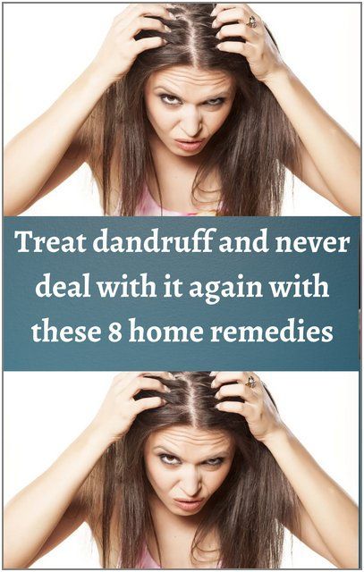 How To Reduce Dandruff, Workspace Lighting, Treat Dandruff, Reduce Dandruff, Office Jobs, Bridal Dresses Pakistan, Dream Cars Jeep, Itchy Scalp, Tired Eyes