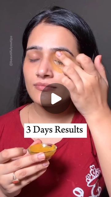 HomeBeautyHack ||Skin care ||Health care|| on Instagram: "3 Days Remove Dark Circles & Eye Wrinkles ❤️

“Say Goodbye to Dark Circles & Eye Wrinkles in just 3 Days!

Get beautiful, radiant eyes with our DIY Night Cream!

Ingredients:

- Coffee grounds
- Flour
- Vitamin E capsule
- Aloe vera gel
- Coconut oil

Instructions:

1. Mix all ingredients well
2. Store and use daily at night
3. Apply and leave on for 10 minutes
4. Wash off and wake up to gorgeous eyes!

Benefits:

- Removes dark circles
- Reduces eye wrinkles
- Hydrates and nourishes the skin

Try this miracle cream and see the difference for yourself!

Cc👉@beautifulyoutips❤️

Follow for more DIY skincare tips and tricks! 
#reels #DarkCircles #EyeWrinkles #DIYNightCream #BeautifulEyes #SkincareTips #NaturalSkincare #GlowingSkin”" To Reduce Dark Circles, Dark Circles Remove Tips, Dark Circles Diy, Baking Soda Under Eyes, Reduce Eye Wrinkles, Dark Circle Remedies, Eye Wrinkles, Dark Eye Circles, Beauty Hacks Skincare