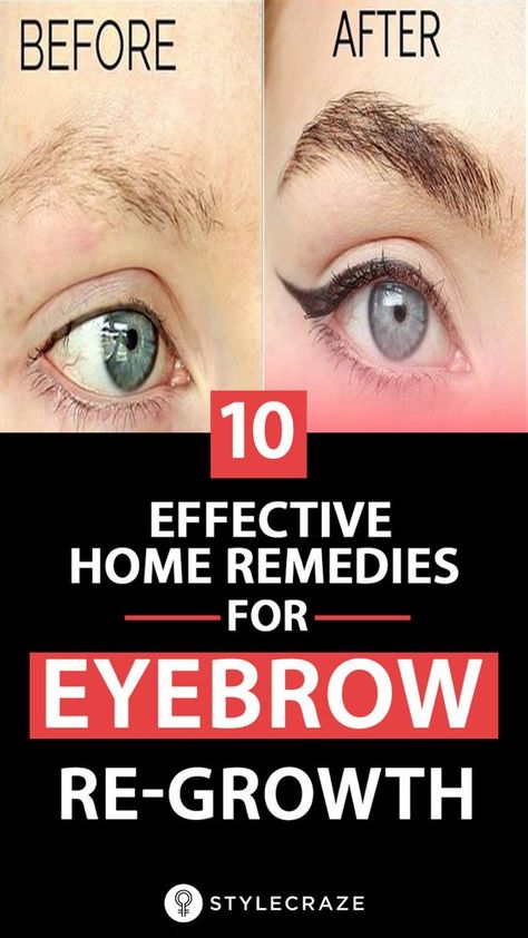 10 Effective Home Remedies For Eyebrow Re-Growth Thinning Eyebrows, Eyebrow Regrowth, Regrow Eyebrows, Eyebrow Hair Growth, Natural Eyebrows Growth, Grow Eyebrows Thicker, Shaped Eyebrows, Fuller Eyebrows, Dark Eyebrows