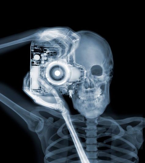 Photographer Nick Veasey has made a name for himself by photographing large objects using X-Rays instead of visible light. The 6-minute video above is a lo Daniel Richter, Tabel Periodik, Xray Art, Andre Kertesz, Charley Harper, Visible Light, Radiology, Anatomy Art, X Ray