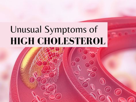 High Cholesterol Symptoms, Enlarged Liver, Cholesterol Symptoms, High Cholesterol Levels, Unhealthy Diet, Lifestyle Habits, High Cholesterol, Abdominal Pain, Cholesterol Levels