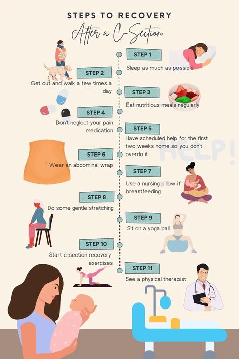 C Section Workout, Postpartum Care Kit, Birth Recovery, C Section Recovery, Post Pregnancy Workout, Baby Delivery, Healthy Pregnancy Tips, Newborn Mom, Postpartum Doula