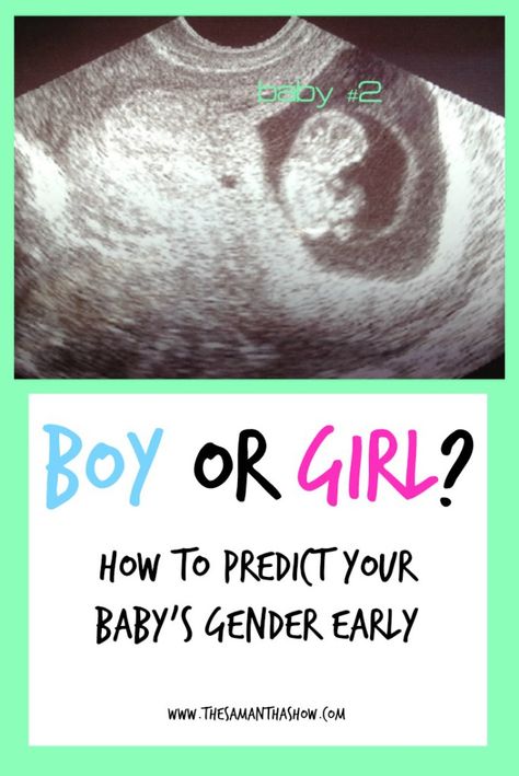 Are you having a boy or a girl? How early can you find out your baby's gender? A certain study shows how to predict your baby's gender early. Girl Or Boy Predictions, Baby Heart Rate Gender, Boy Or Girl Test, Early Gender Prediction, Ultrasound Gender Prediction, Gender Myths, Boy Or Girl Prediction, Boy Ultrasound, Gender Prediction Chart