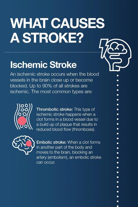 Types Of Strokes, Brain Surgeon, Amino Acid Supplements, Health And Fitness Magazine, Healthy Diet Tips, Daily Health Tips, Lower Blood Sugar, Fitness Advice, Good Health Tips