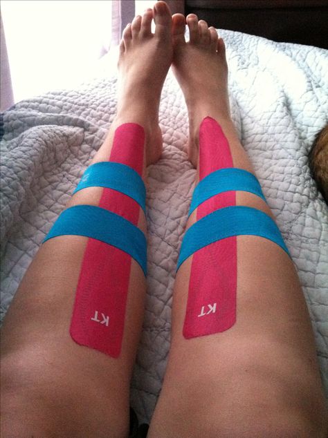 KT tape for shin splints, first along shin second and third above and below pain at 80 percent stretch. Shin Splints Taping, Shin Splint Exercises, K Tape, Kt Tape, Kinesio Taping, Running Injuries, Kinesiology Taping, 80 Percent, Shin Splints