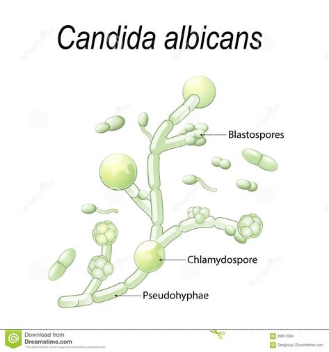 Illustration about Candida albicans is a type of yeast causes candidiasis fungal infection in gastrointestinal, urinary and respiratory tract. pathogenic flora. Illustration of human, fungus, microorganism - 99812084 Yeast Infection Pictures, Yeast Infection Men, Yeast Infection During Pregnancy, Chronic Yeast Infection, Candida Yeast Infection, Yeast Infection Causes, Yoga Information, Candida Yeast, Candida Albicans