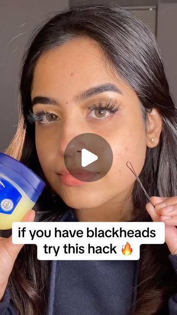 Remove Blackheads From Nose, Blackheads And Whiteheads, Blackheads On Nose, Clean Blackheads, Exfoliate Skin, Remove Blackheads, Make Up Videos, Petroleum Jelly, Glowing Skincare