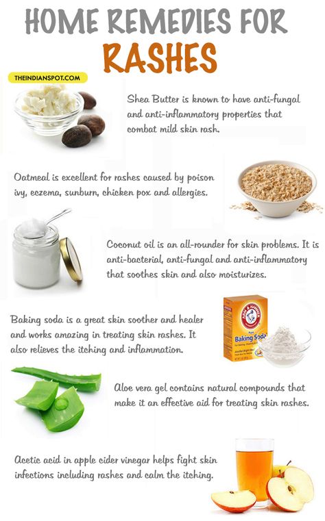 Home Remedies For Rashes, Skin Rashes, Allergy Remedies, Home Remedies For Acne, Holistic Remedies, Natural Therapy, Skin Remedies, Skin Care Remedies, Natural Home Remedies