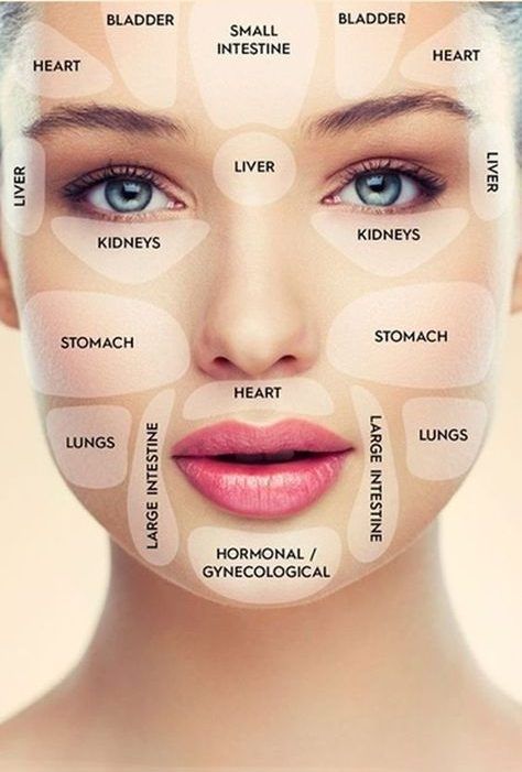 Gesicht Mapping, Face Mapping, Home Beauty Tips, Clear Skin Tips, Face Acne, Acne Remedies, How To Get Rid Of Acne, Acne Skin, Skin Tips