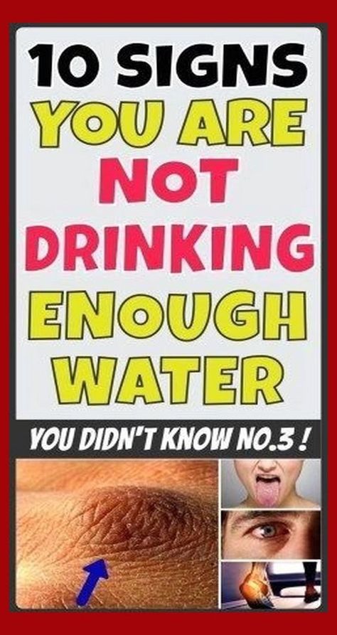 10 SIGNS YOU ARE NOT DRINKING ENOUGH WATER Drinking Enough Water, Not Drinking Enough Water, Water Retention, Diy Beauty Hacks, Natural Herbs, Natural Medicine, Herbal Remedies, Health Problems, Healthy Tips