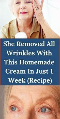 Boyfriend Jealous, Mouth Wrinkles, Wrinkle Remedies, Wrinkle Free Skin, Neck Wrinkles, Skin Care Wrinkles, Face Wrinkles, Low Cholesterol, Wrinkled Skin