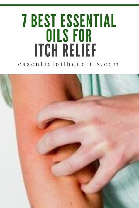 Herbs To Stop Itching, Natural Remedies For Itchy Skin, Best Essential Oils For Dry Skin, Essential Oils For Itching Skin, Essential Oil Itch Relief, Doterra Itch Relief, Natural Itch Relief Skin, Diy Itchy Skin Relief, Essential Oils For Itchy Rash