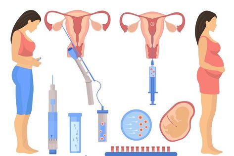 In vitro fertilization flat elements with preparation and process of artificial insemination isolated vector illustration. Archive contains JPG and EPS files Pregnant Anatomy, Fertilization Process, Invitro Fertilization, Artificial Insemination, In Vitro Fertilization, In Vitro, Baby Illustration, Fitness Workout, Fertility