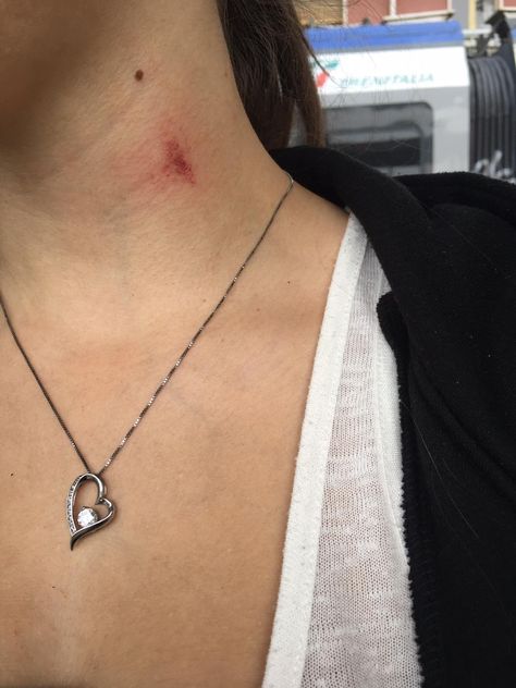 Hickies Neck Aesthetic, Hickies Neck, Neck Kisses, Love Kiss, Aesthetic Love, Illustrations And Posters, Kiss Me, Arrow Necklace, Kiss