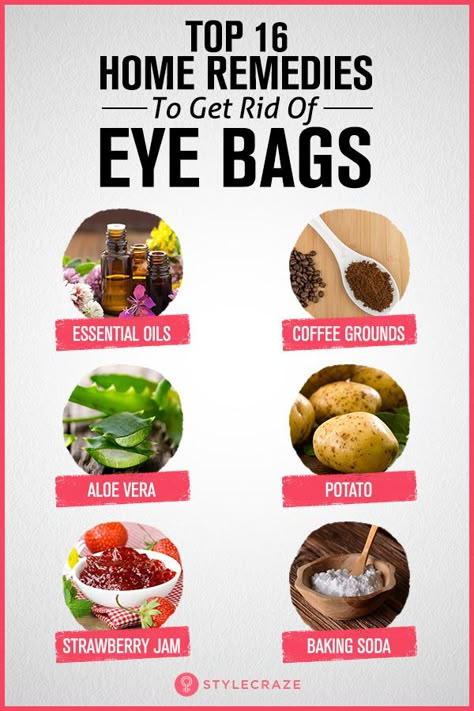 Top 16 Home Remedies To Get Rid Of Eye Bags Home Remedy For Puffy Eyes Bags, Eyes Bags Remedy, Undereye Bags Remedy Get Rid Of, Eyebags Remedy Under Eyes, How To Get Rid Of Eye Bags Fast, Eye Bags Remedy, Baking Soda Under Eyes, Undereye Bags Remedy, Get Rid Of Eye Bags